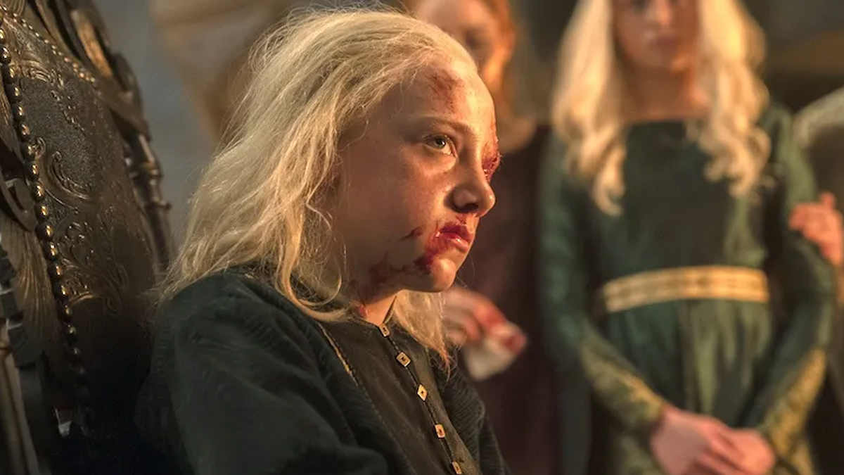 Child Aemond targaryen damaged eye